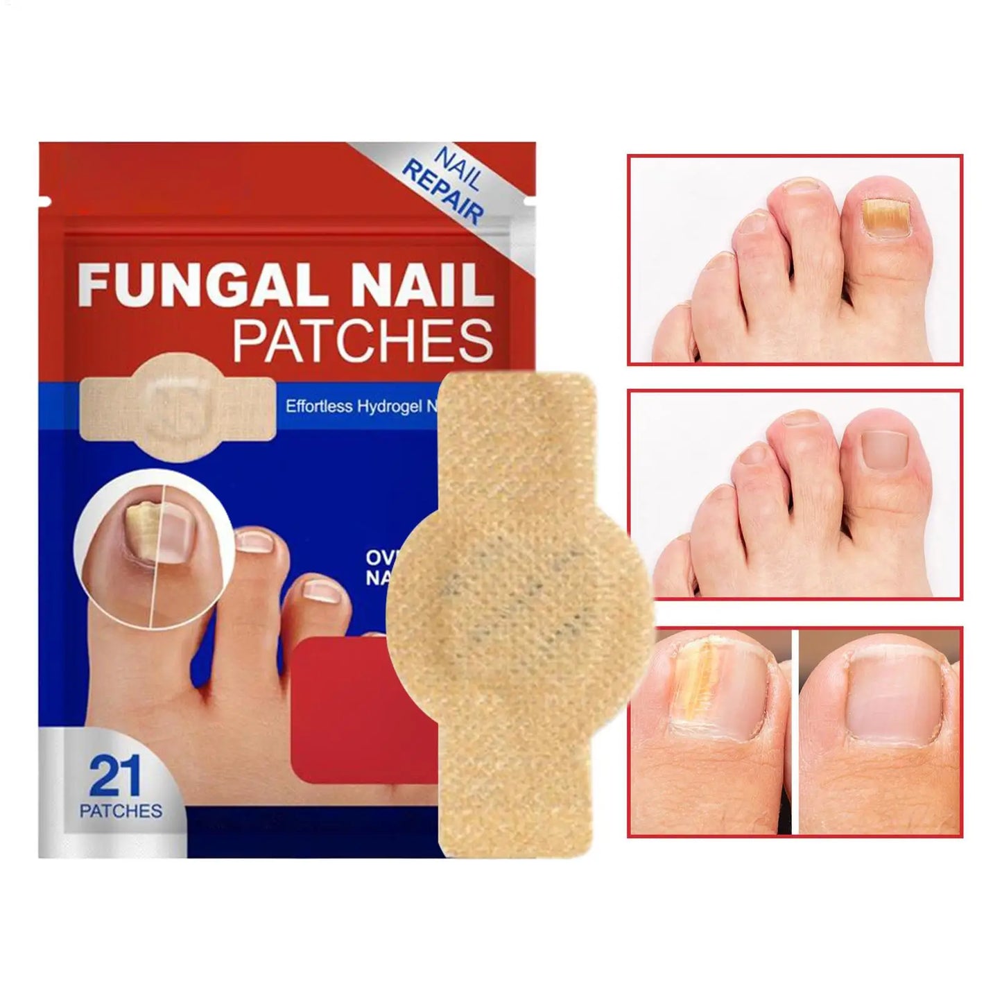 Nail Repair & Fungus Patch – Waterproof Foot Care Sticker