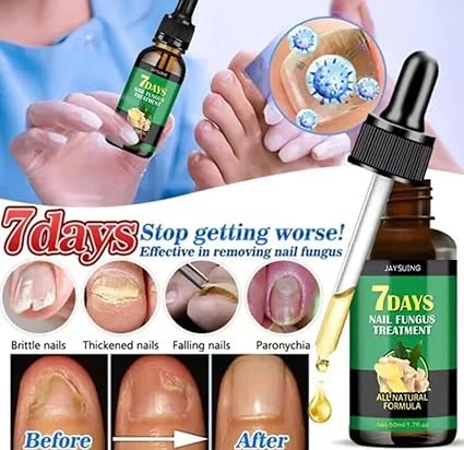 7 Days Nail Fungal Treatment Essence Oil Foot Toe Nail Fungus Removal Serum