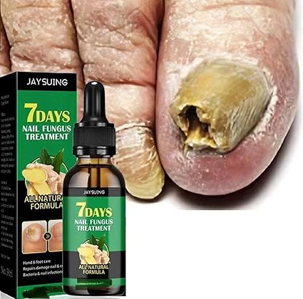7 Days Nail Fungal Treatment Essence Oil Foot Toe Nail Fungus Removal Serum