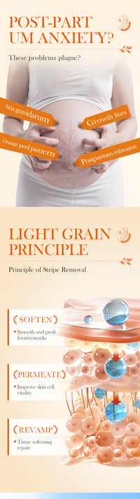 Stretch Mark Repair Cream – Permanent Removal & Firming