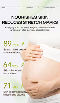 Stretch Mark Removal Cream – Repair & Firm Skin (50g)