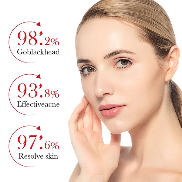 BIOAQUA Salicylic Acid Acne Cream – Clear & Moisturize Skin