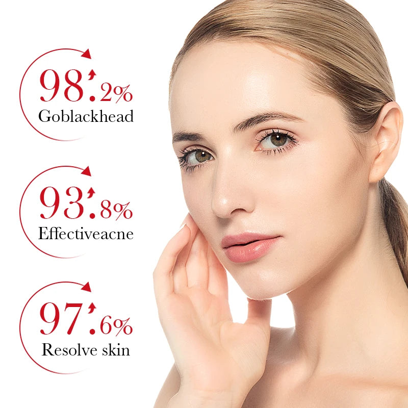 BIOAQUA Salicylic Acid Acne Cream – Clear & Moisturize Skin