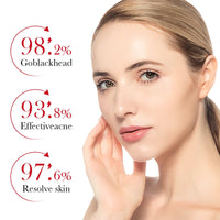 BIOAQUA Salicylic Acid Acne Cream – Clear & Moisturize Skin