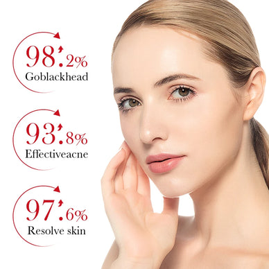 Reveal Your Radiant Complexion, Banish Acne Forever!