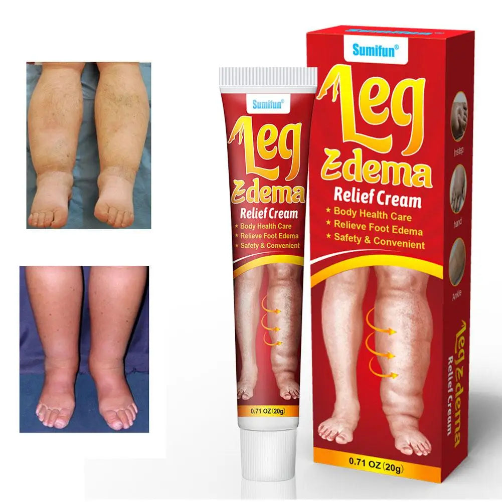 Anti-Swelling Leg & Foot Relief Cream – 20g