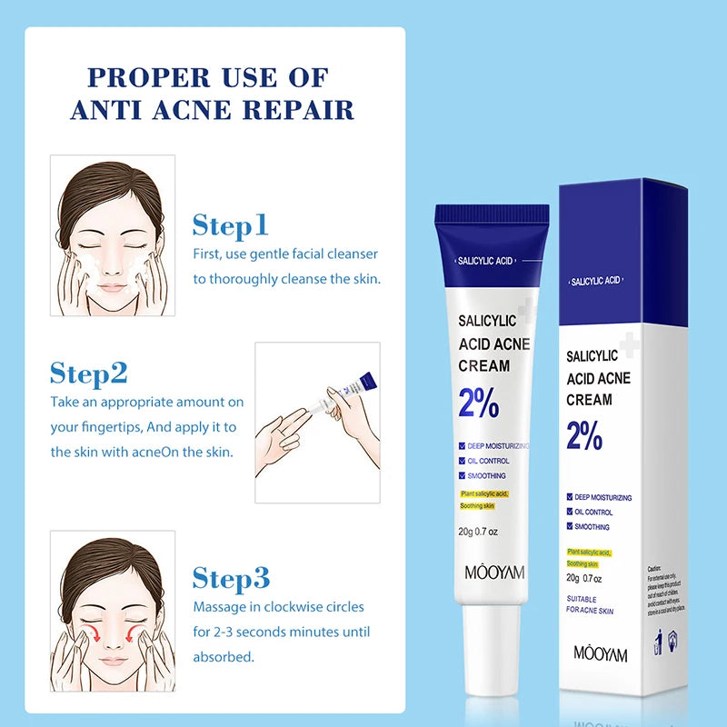 Salicylic Acid Acne Cream – Clear, Soothe & Repair Skin
