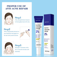 Salicylic Acid Acne Cream – Clear, Soothe & Repair Skin