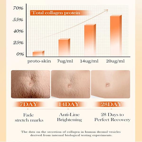 Stretch Mark Repair Cream – Permanent Removal & Firming