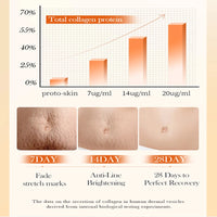 Stretch Mark Repair Cream – Permanent Removal & Firming