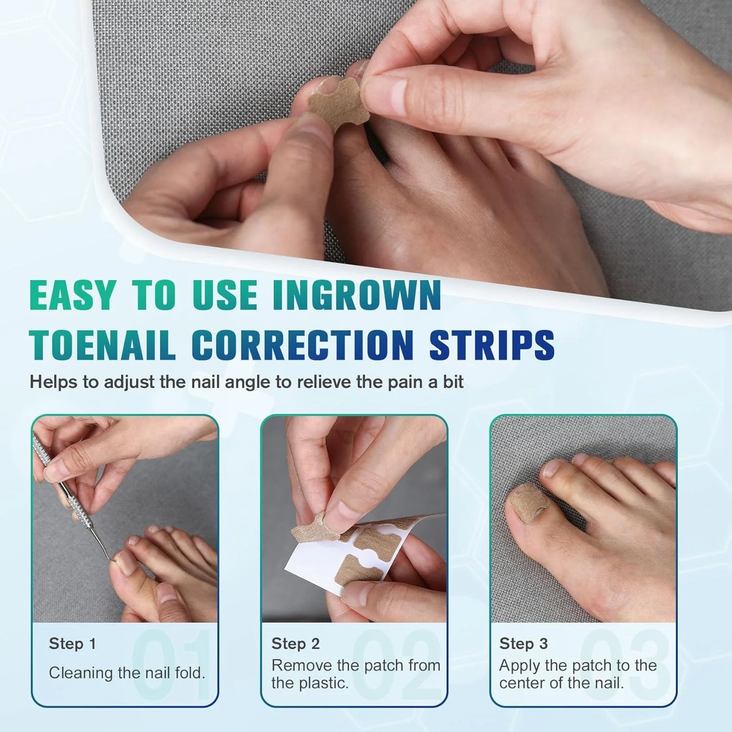 50/100pcs Nail Correction Stickers Ingrown Toenail Corrector Patches Paronychia Treatment Recover Corrector Pedicure Tools