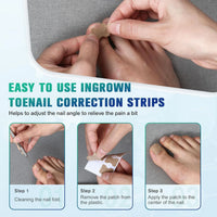 50/100pcs Nail Correction Stickers Ingrown Toenail Corrector Patches Paronychia Treatment Recover Corrector Pedicure Tools