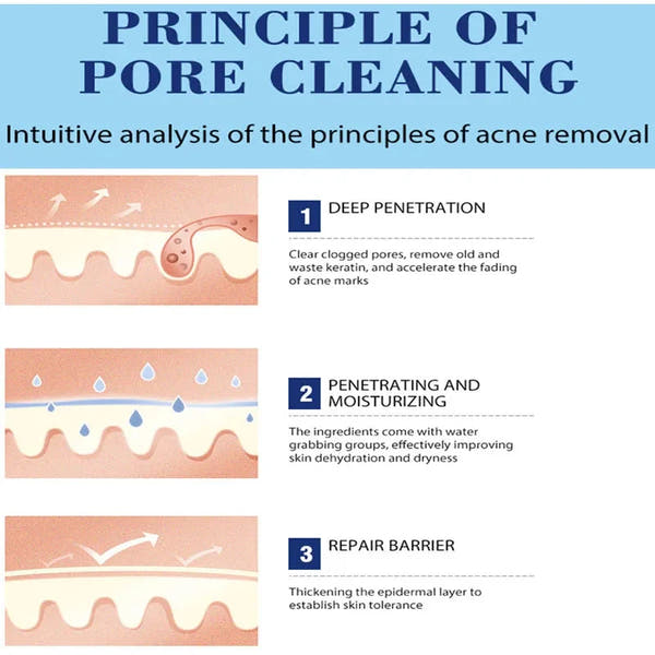 Salicylic Acid Acne Cream – Clear, Soothe & Repair Skin