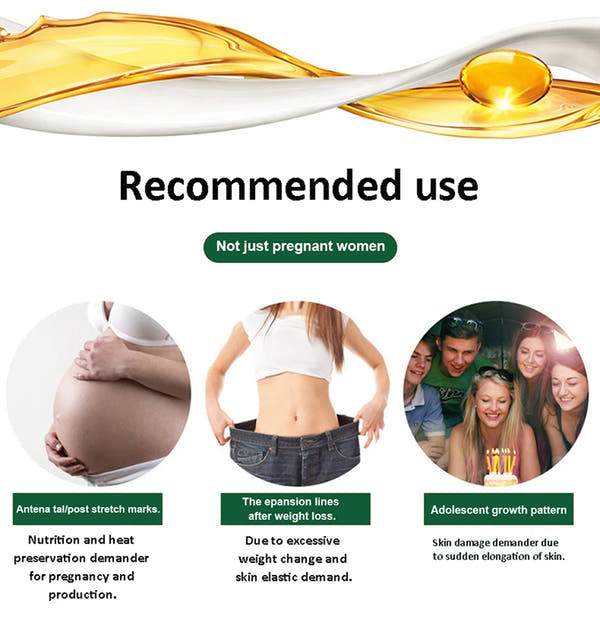 Stretch Mark Repair Cream – Permanent Removal & Firming