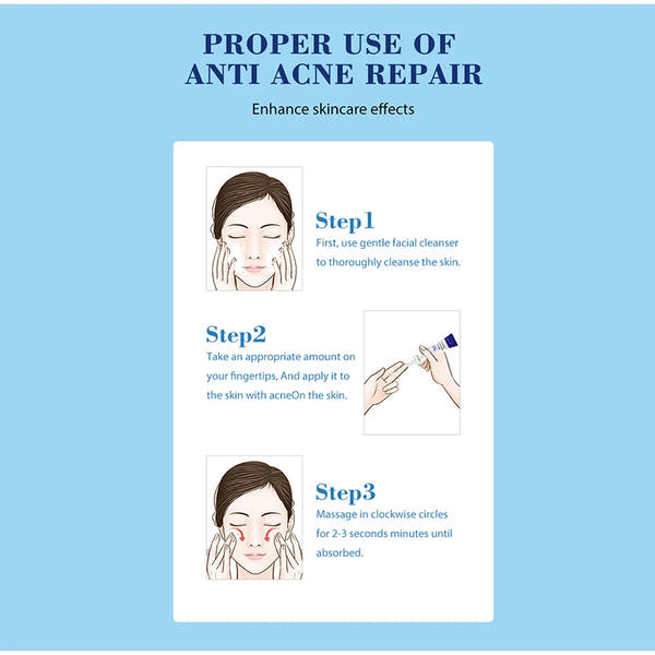 Salicylic Acid Acne Cream – Clear, Soothe & Repair Skin