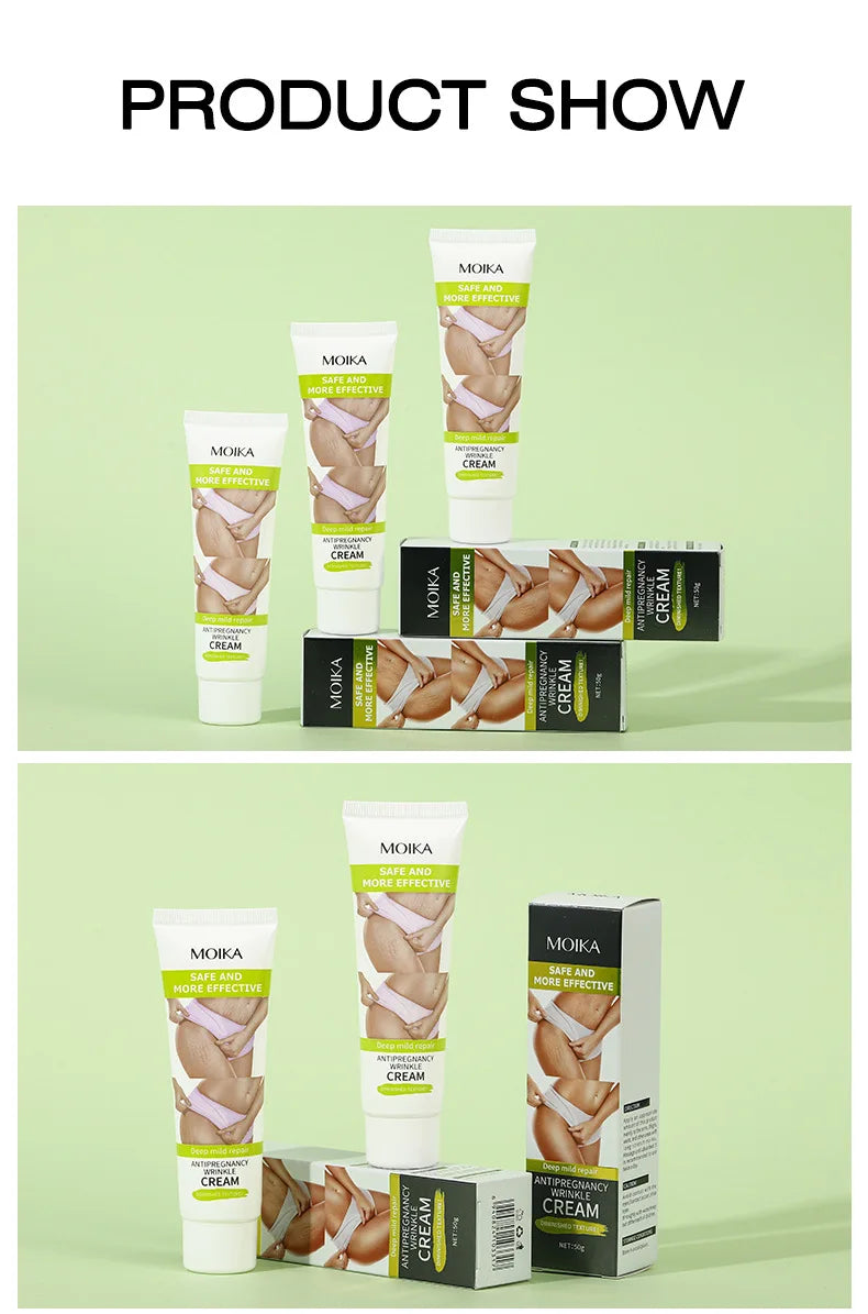 Stretch Mark Removal Cream – Repair & Firm Skin (50g)