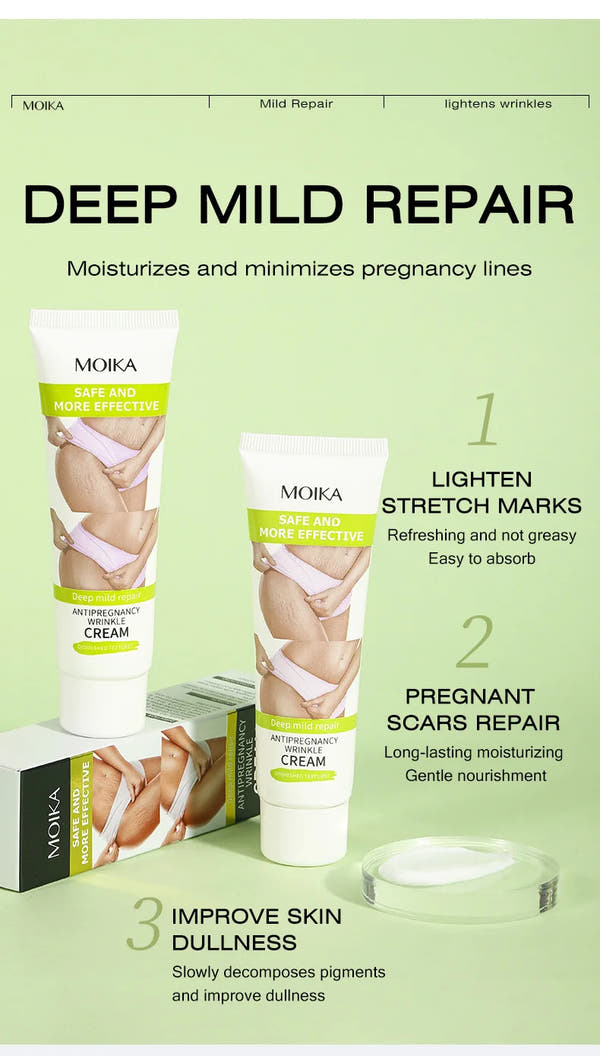Stretch Mark Removal Cream – Repair & Firm Skin (50g)