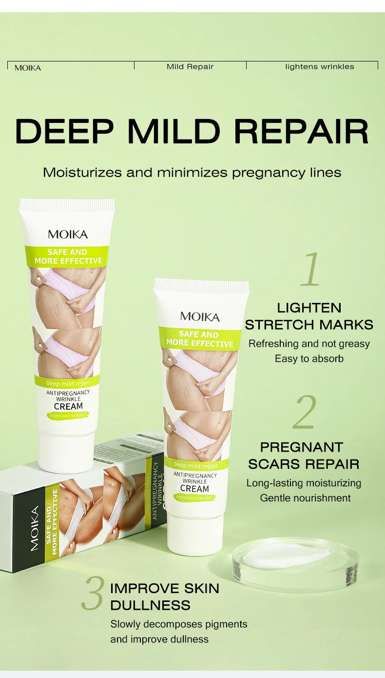 Stretch Mark Removal Cream – Repair & Firm Skin (50g)