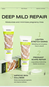 Stretch Mark Removal Cream – Repair & Firm Skin (50g)