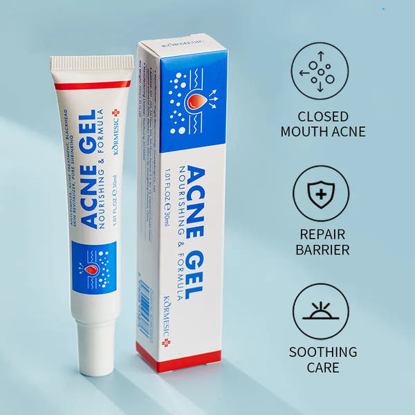 Herbal Acne Treatment Cream – Clear Scars & Control Oil