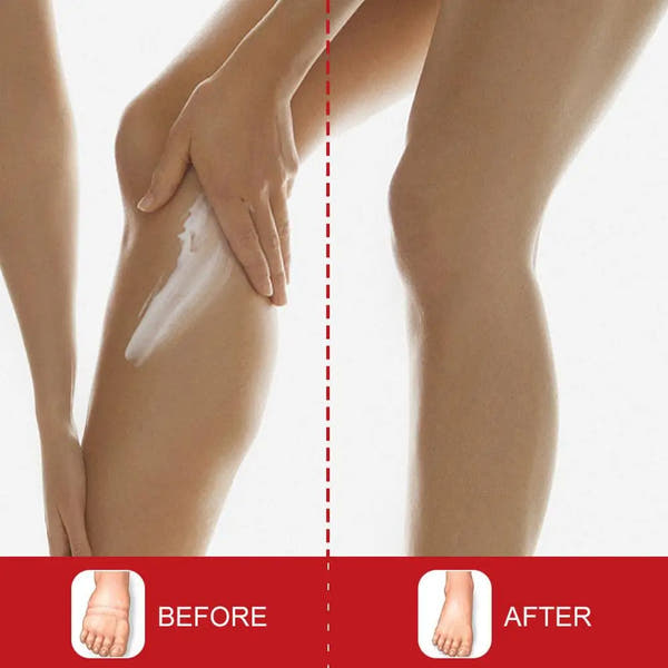 Anti-Swelling Leg & Foot Relief Cream – 20g