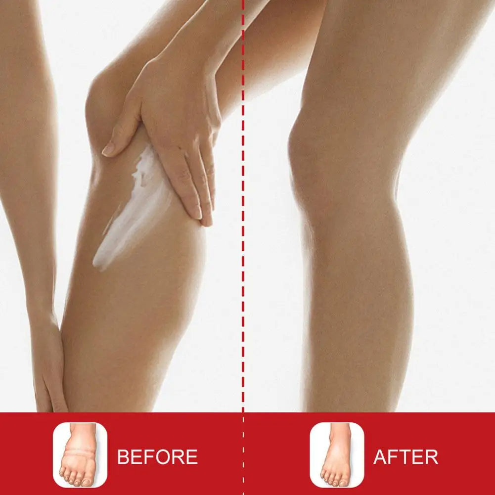Anti-Swelling Leg & Foot Relief Cream – 20g