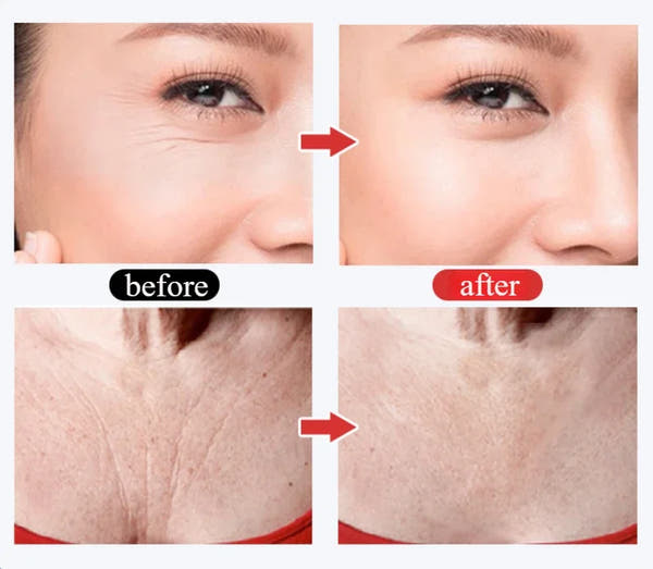 Silicone Anti-Wrinkle Pads – Reusable Face, Neck & Forehead Lift