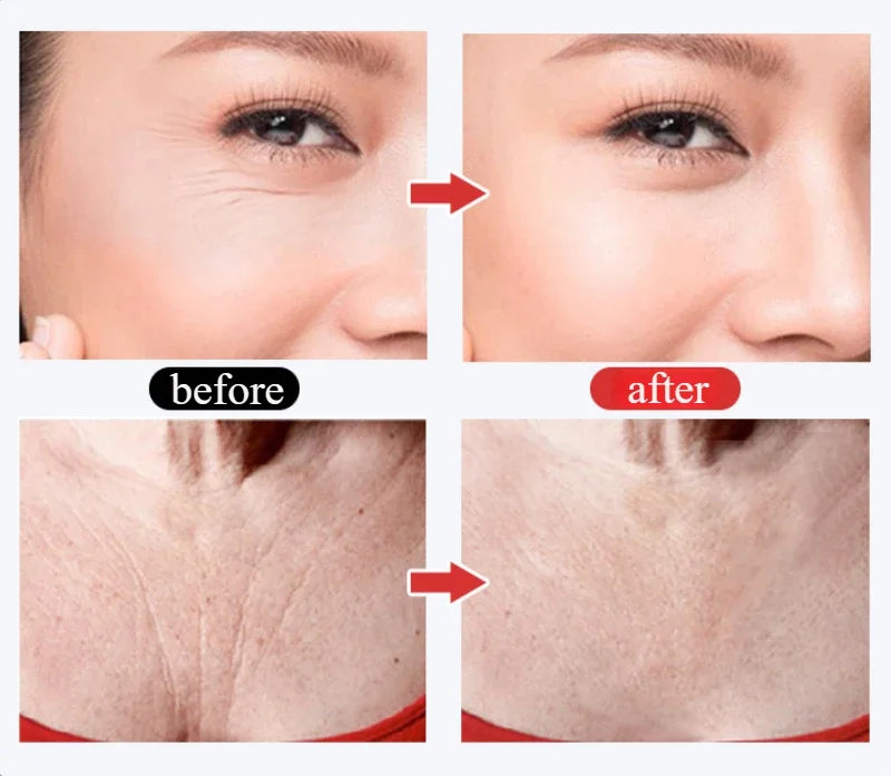 Silicone Anti-Wrinkle Pads – Reusable Face, Neck & Forehead Lift