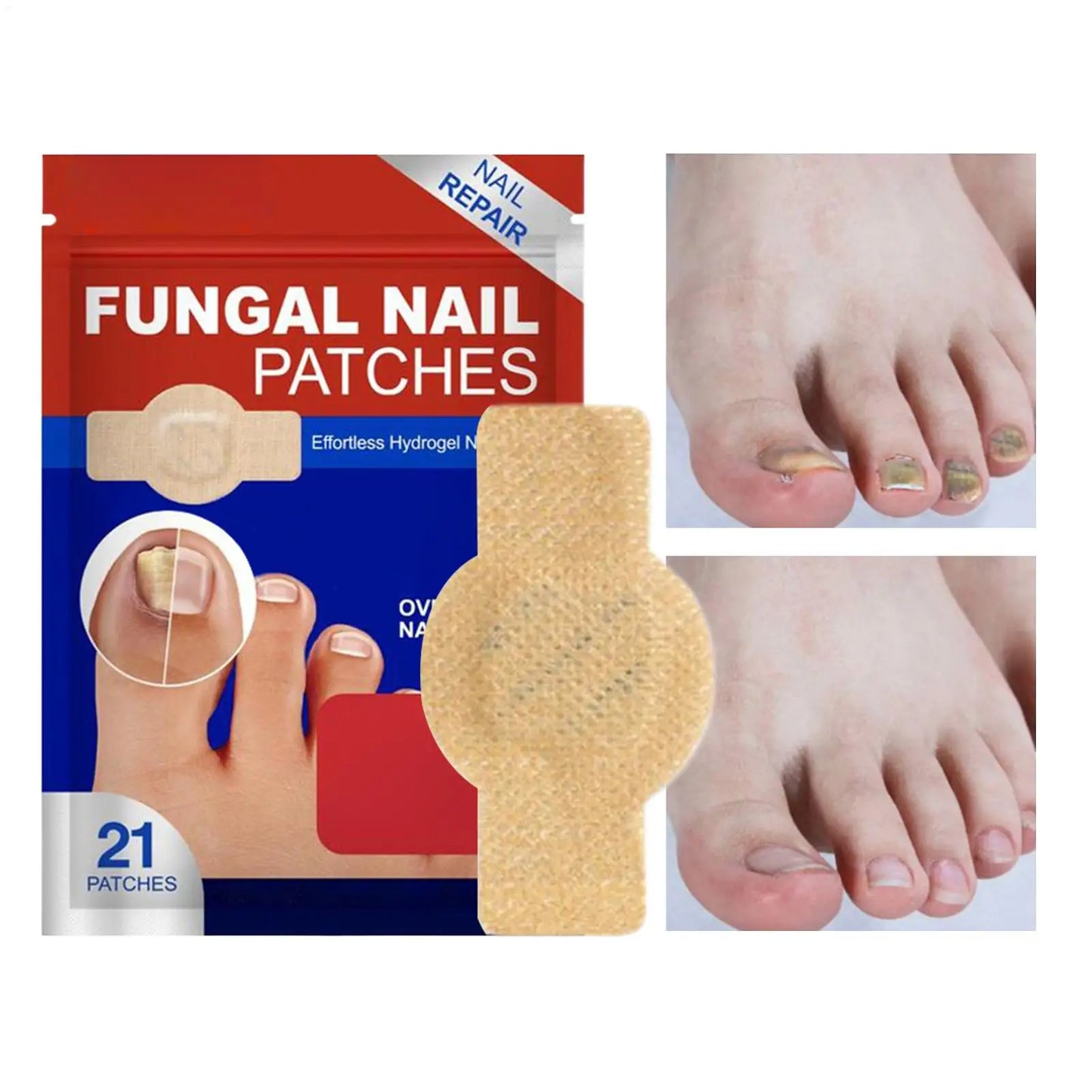 Nail Repair & Fungus Patch – Waterproof Foot Care Sticker
