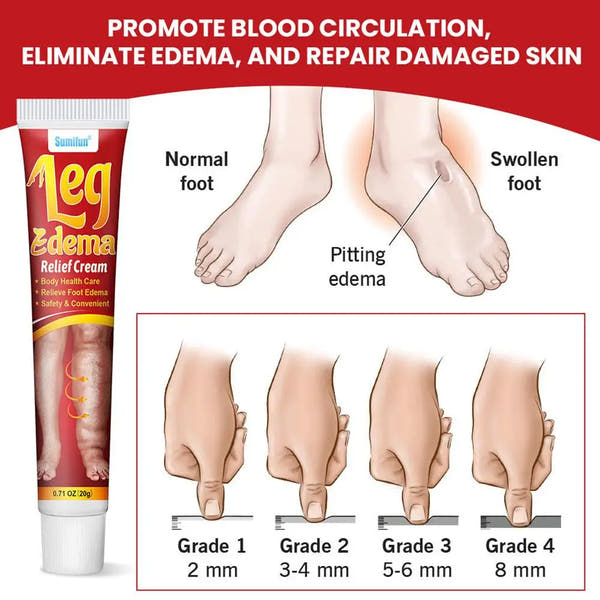 Anti-Swelling Leg & Foot Relief Cream – 20g