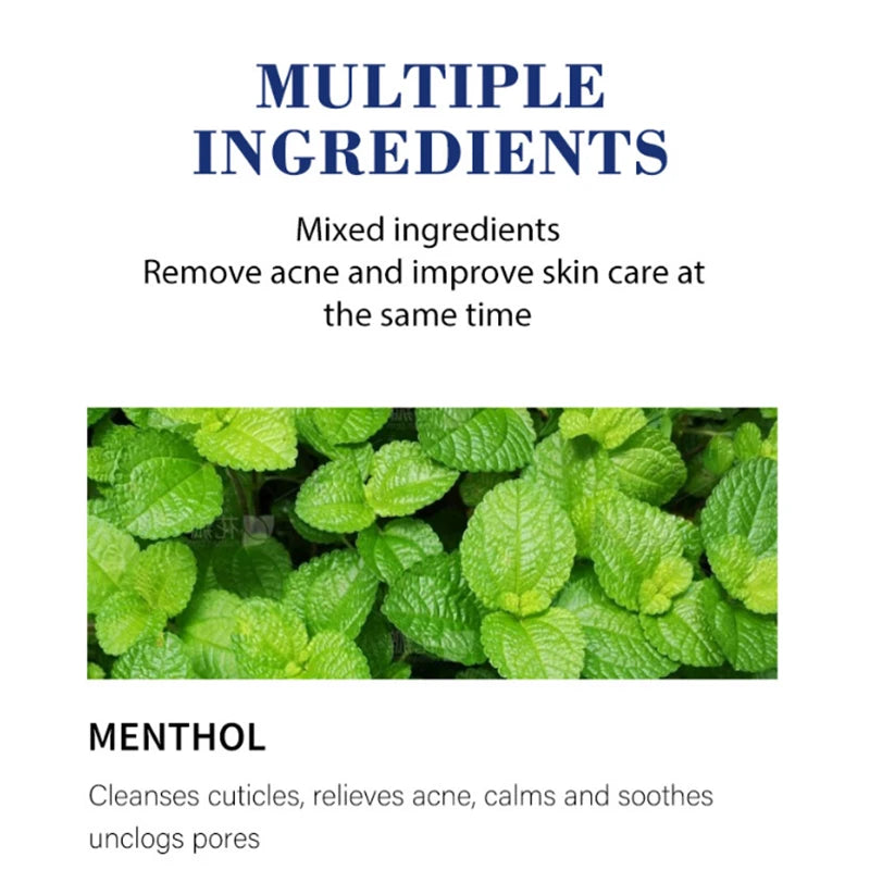 Salicylic Acid Acne Cream – Clear, Soothe & Repair Skin