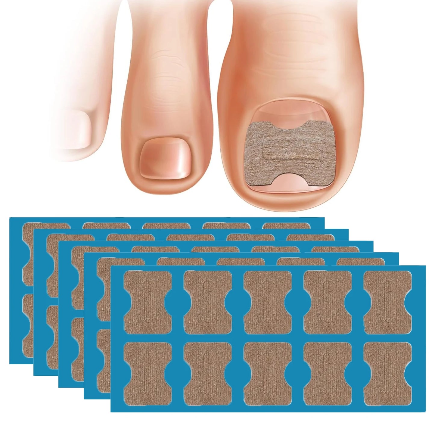 50/100pcs Nail Correction Stickers Ingrown Toenail Corrector Patches Paronychia Treatment Recover Corrector Pedicure Tools