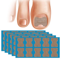 50/100pcs Nail Correction Stickers Ingrown Toenail Corrector Patches Paronychia Treatment Recover Corrector Pedicure Tools